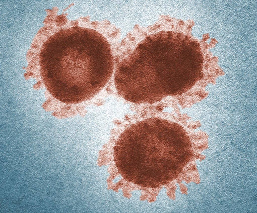 Coronavirus